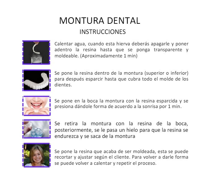 Carillas Dentales
