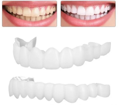 Carillas Dentales